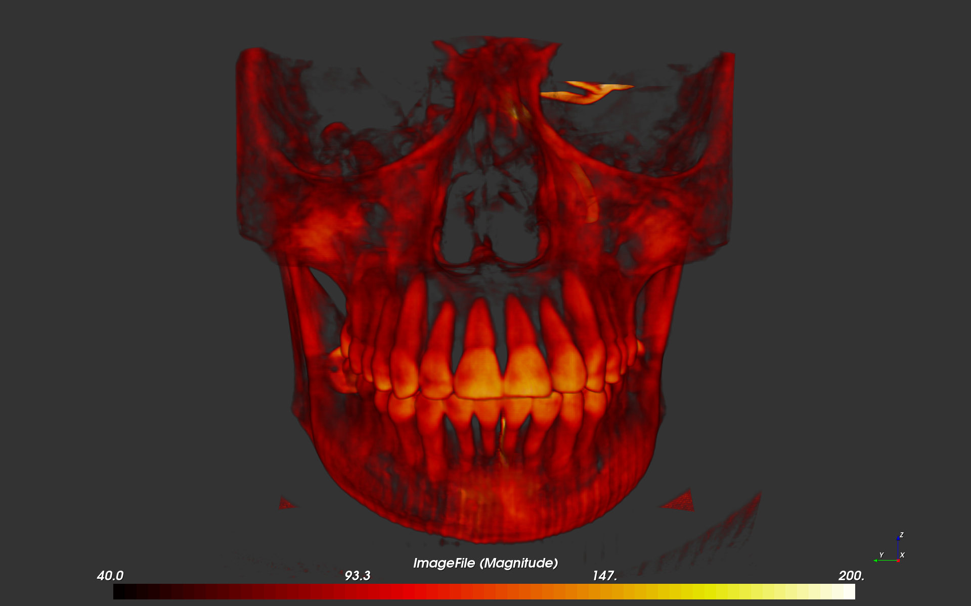 F3D