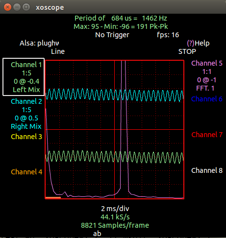 Xoscope